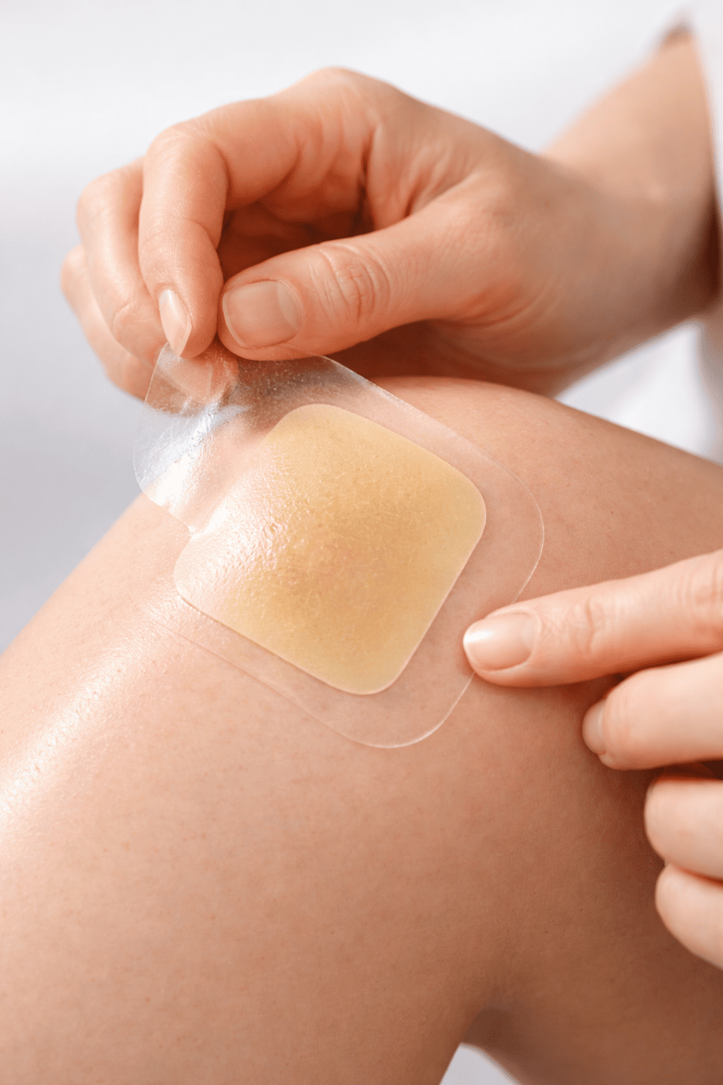 Applying hydrocolloid dressing to a wound