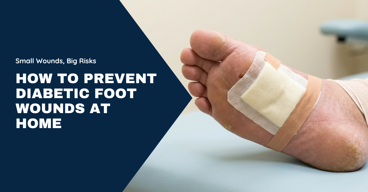 Diabetic foot care at home to prevent wounds and complications