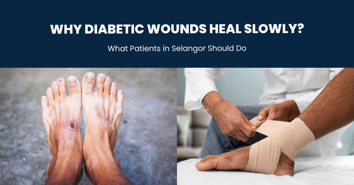 Why Diabetic Wounds Heal Slowly? Wound Care at home